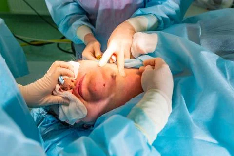Plastic surgery in operating room. Circular face lift Stock Photos