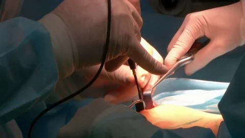 Plastic surgery an operating room Video stock 75987462