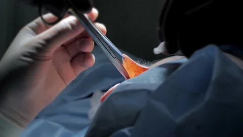 Plastic surgery operation on face. Close-up of surgery. Surgeon hands cut off Stock Footage 130604102