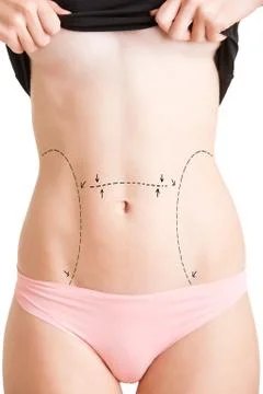 Plastic Surgery Foto stock