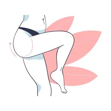 Plastic Surgery with Thigh Body Part Correction in Aesthetic Beauty Clinic Stock Illustration