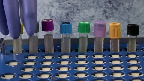 Plastic test tubes with caps for the collection of samples. Test tube rack. M Stock Footage 166282439