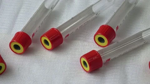 Plastic test tubes with caps for the collection of samples. Medical modern me Stock Footage 166282583