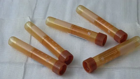 Plastic test tubes with caps for the collection of samples. Medical modern me Stock Footage 166282857