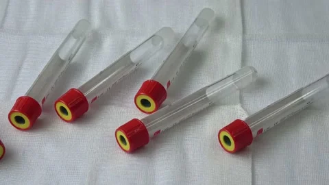 Plastic test tubes with caps for the collection of samples. Medical modern me Stock Footage 167753039