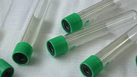 Plastic test tubes with green caps for the collection of samples. Medical mod Stock Footage 166117886