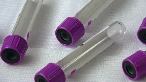 Plastic test tubes with violet caps for the collection of samples. Medical mo Stock Footage 166117860