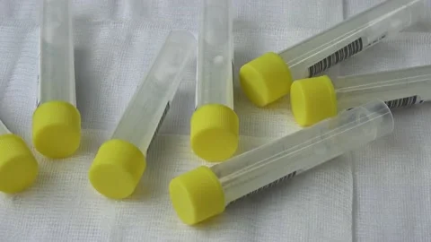 Plastic test tubes with yellow caps for the collection of samples. Medical mo Stock Footage 166104079