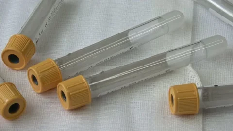 Plastic test tubes with yellow caps for the collection of samples. Medical mo Stock Footage 166117928