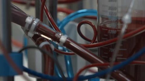 Plastic tubes with circulating blood during medical operation. Blood pump Stock Footage 102221348