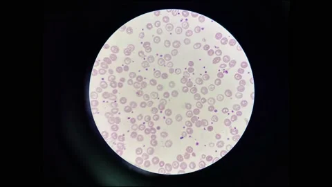 Platelet increase stop motion. Stock Footage 231120113