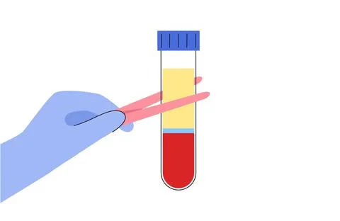 Platelet rich plasma concept Stock Illustration