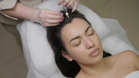 Platelet rich plasma injection procedure. Hair growth stimulation. PRP therapy Stock Footage 268646701