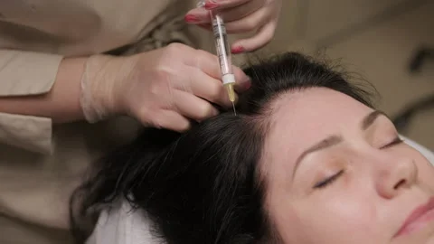 Platelet rich plasma injection procedure. Hair growth stimulation. PRP therapy Stock Footage 268647437