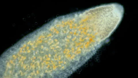 Platyhelminthes worm under a microscope. Species not defined. Specimen found in Stock Footage 260791554