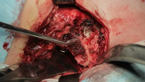 Pluck Out The Bone Stockfoto's