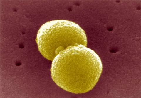  Pneumococcus Scanning Electron Micrograph of Streptococcus pneumoniae. Co... Stock Photos