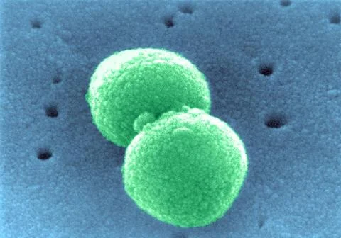  Pneumococcus Scanning Electron Micrograph of Streptococcus pneumoniae. Co... Stock Photos