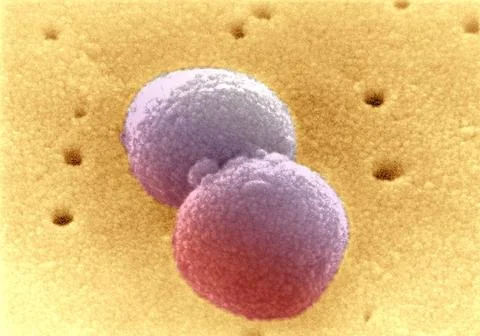  Pneumococcus Scanning Electron Micrograph of Streptococcus pneumoniae. Co... Stock Photos