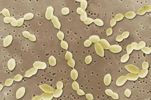 PNEUMOCOCCUS Viewed under scanning electron microscope (SEM). Copyright: x... Stock Photos