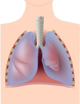 Pneumothorax Stock Illustration