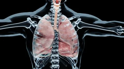Pneumothorax, Normal lung versus collapsed, symptoms of pneumothorax, pleural Stock Illustration