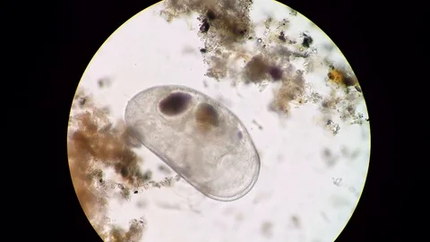 Podocopida or seed shrimp micro crustacean swimming through soil material Vídeos de archivo 122107997
