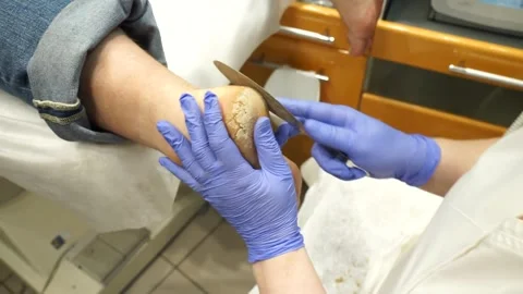 Podologic pedicure 3 Stock Footage 178442253