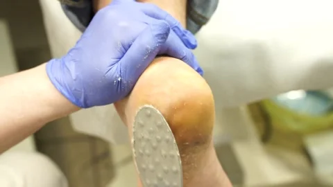 Podologic pedicure 4 Stock Footage 178441564