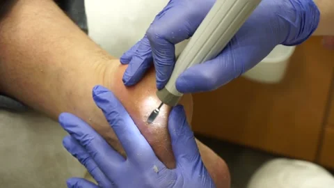 Podologic pedicure 6 Stock Footage 178441362