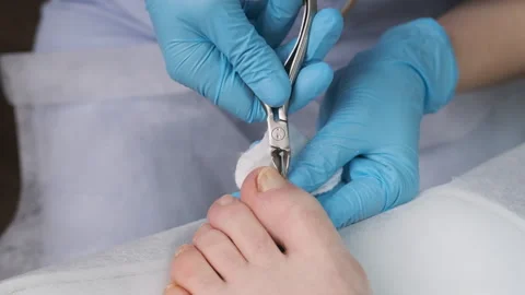 Podologist does pedicure using clippers and cutting nails Stock Footage 273318624