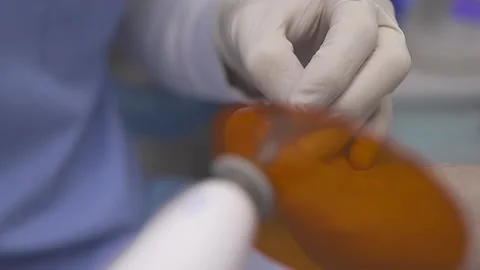 Podologist heats the guide bracket with the device on the patient diseased nail Stock Footage 169796237