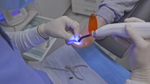 Podologist heats the guide bracket with the device on the patient diseased nail Stock Footage 169796351