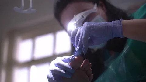 The podologist scrapes the nail with a buffing attachment Stock Footage 268618384