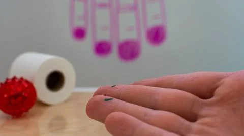 A point found and marked with a marker on the finger Stock Photos