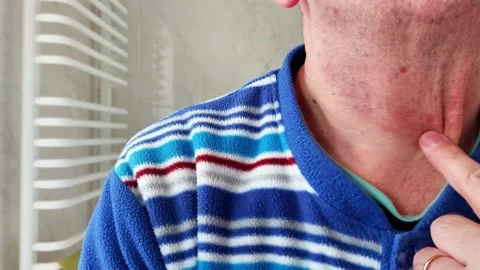 Pointing to Irritated Neck Area While Wearing Blue Striped Shirt in Bathroom Video stock 329213385
