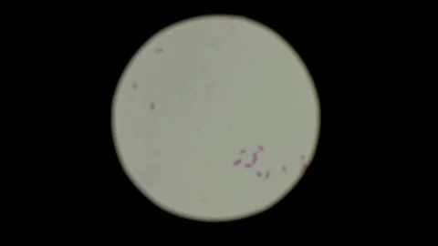 Poliovirus under the microscope, in an eradication study. in the laboratory Stock Footage 336583779