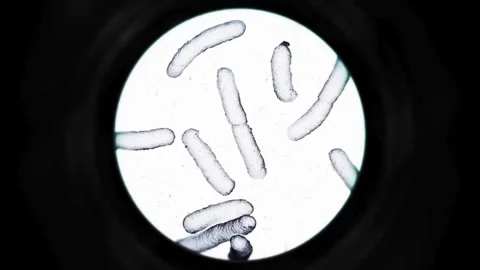 Poliovirus under the microscope, in an eradication study. in the laboratory Stock Footage 336583800