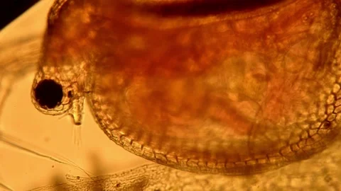 Poliovirus under the microscope, in an eradication study. in the laboratory Stock Footage 336583831