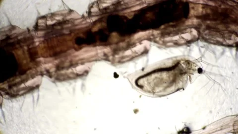 Poliovirus under the microscope, in an eradication study. in the laboratory Stock Footage 336583837