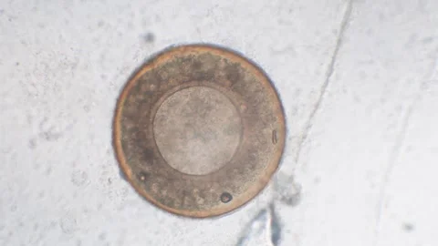 Pollen grain at microscope, pollen Stock Footage 262560926