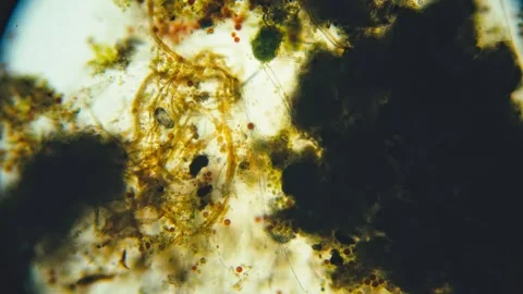 Polluted water sample under microscope revealing microorganisms and organic.. Stock Footage 336666570