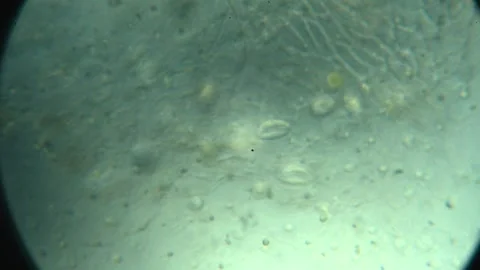 Polluted water sample under microscope revealing microorganisms and organic.. 스톡 동영상 336943236