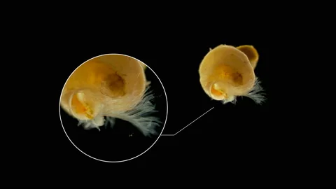 Polychaeta worm under a microscope, the Spirorbidae family Stock Footage 136037413