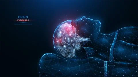 Polygonal vector illustration of human brain disease on a dark blue backgroun Stock Illustration