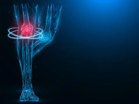 Polygonal vector illustration of human legs, painful and inflamed knee. Sick  Stock Illustration