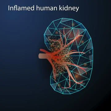 Polygonal vector illustration of an inflamed human kidney on a dark blue back Stock Illustration