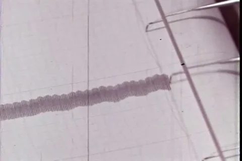 Polygraph shows level of blood pressure and pharmacologist give injection - 動画素材 106226193
