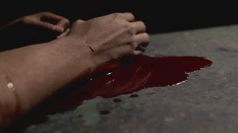 Pool of Dark Red Blood Forms Around Injured Young Male Video stock 61520817