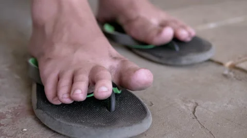 Poor Child Moving Dirty Bare Feet, Wiggling Fingers, Doing Relaxation Exercises Stock-Footage 236037842